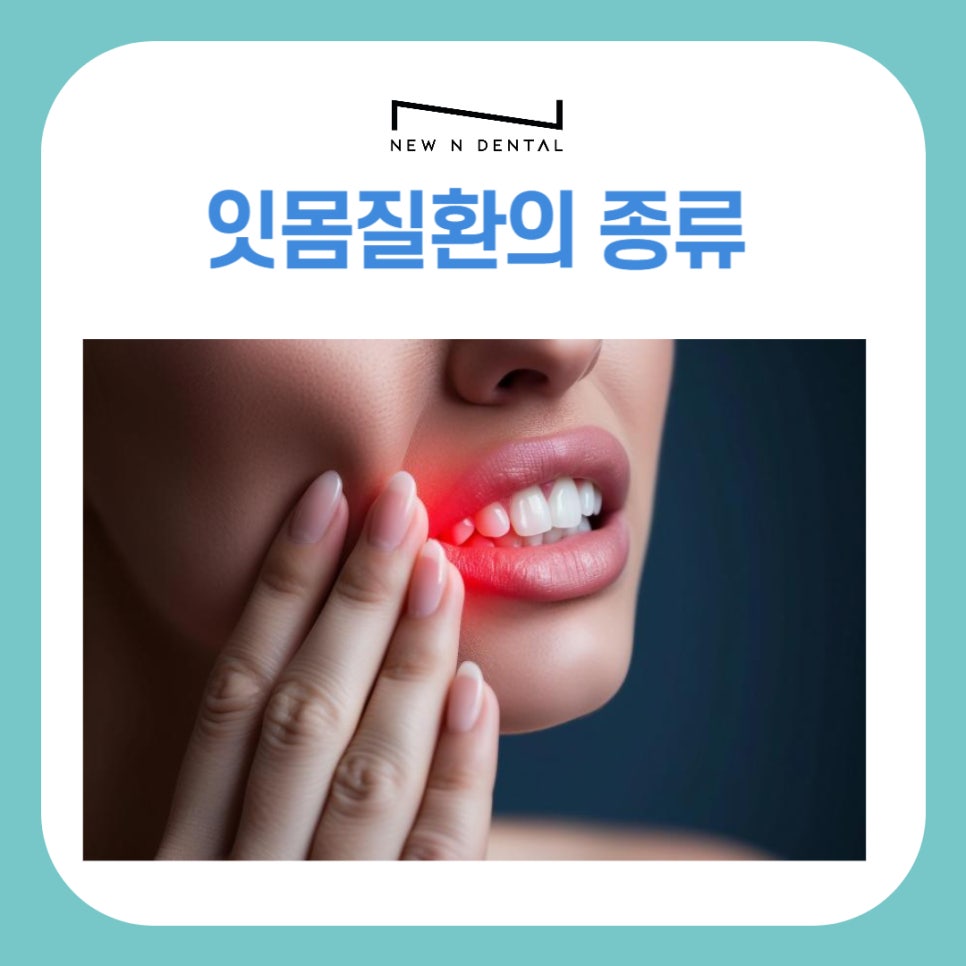 잇몸질환의 종류 출혈이 있을 때 예방방법 관련 이미지 2