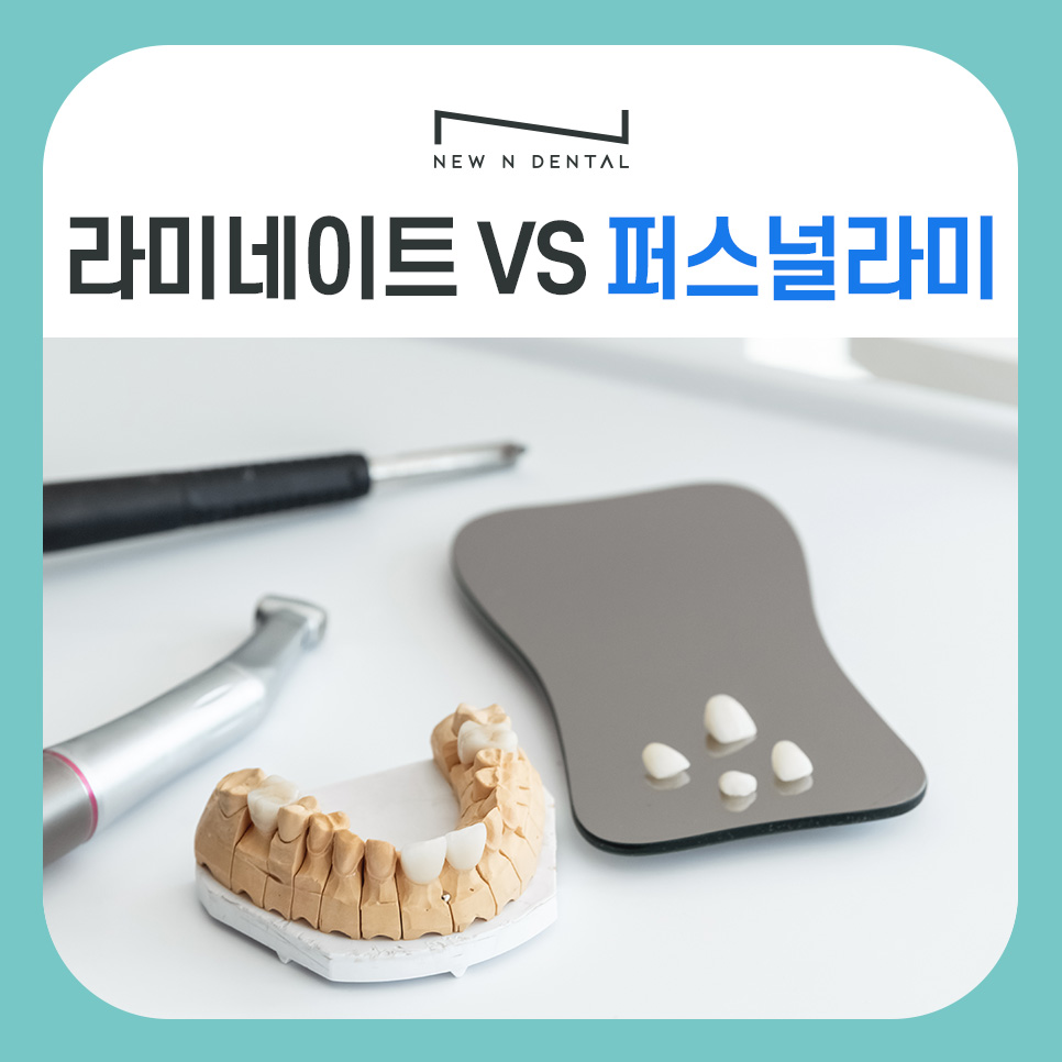 강남역 뉴엔치과 일반 라미네이트와 퍼스널라미의 차이점 관련 이미지 1