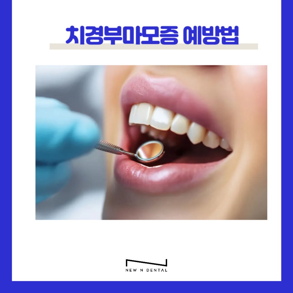 신논현치과 치경부마모증 원인과 치료 관련 이미지 11