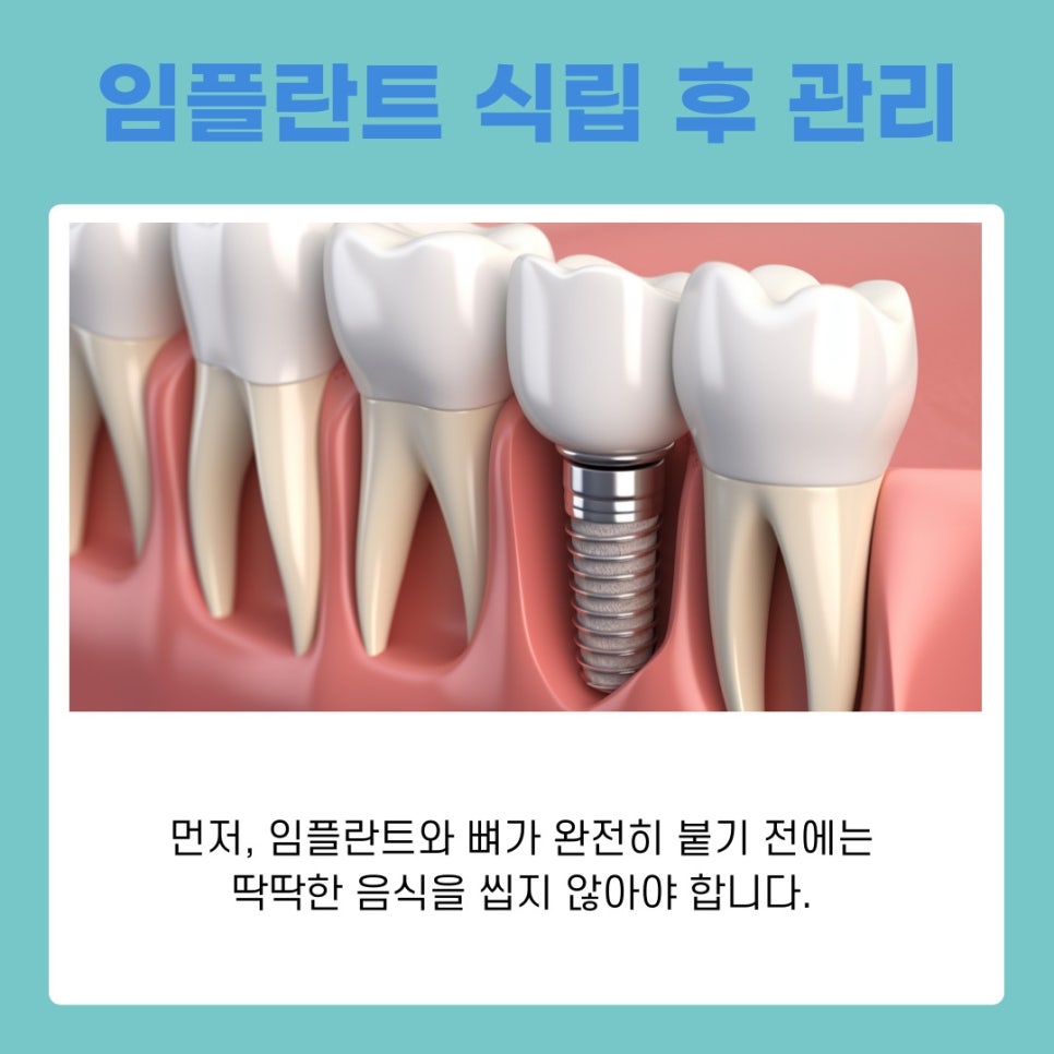 강남역치과 임플란트 식립 후 식사, 회복 과정 따라 달라지는 식단 팁 관련 이미지 7