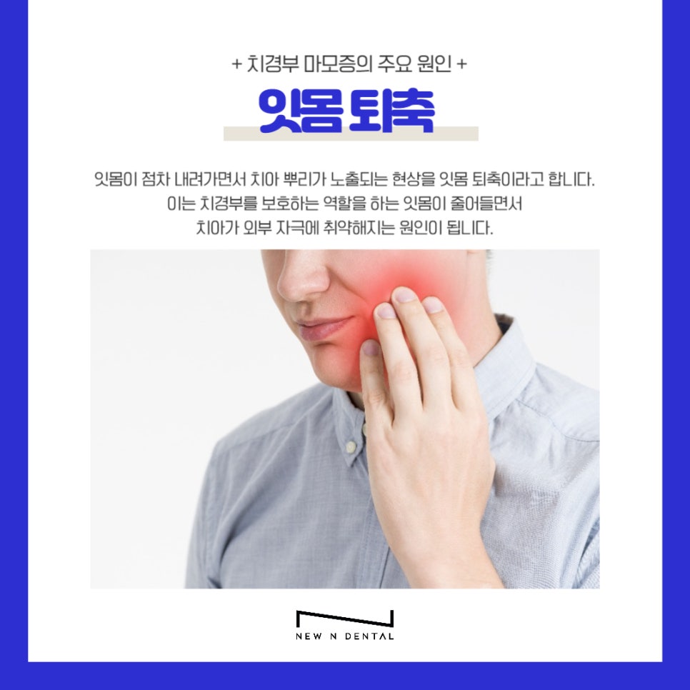 신논현치과 치경부마모증 원인과 치료 관련 이미지 8