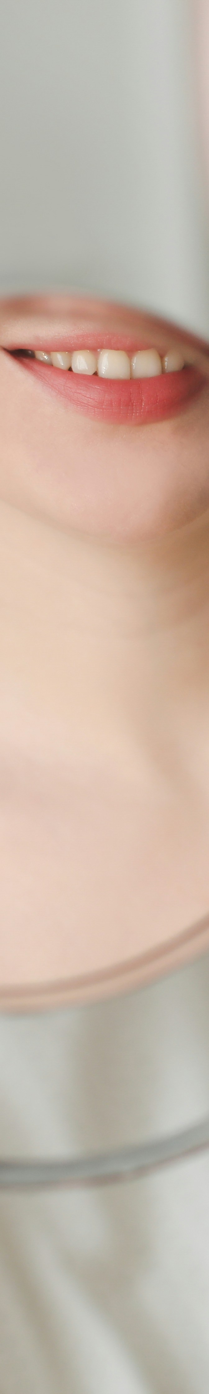 치아 미백 효과와 부작용 체크해야 할 사항 관련 이미지 10