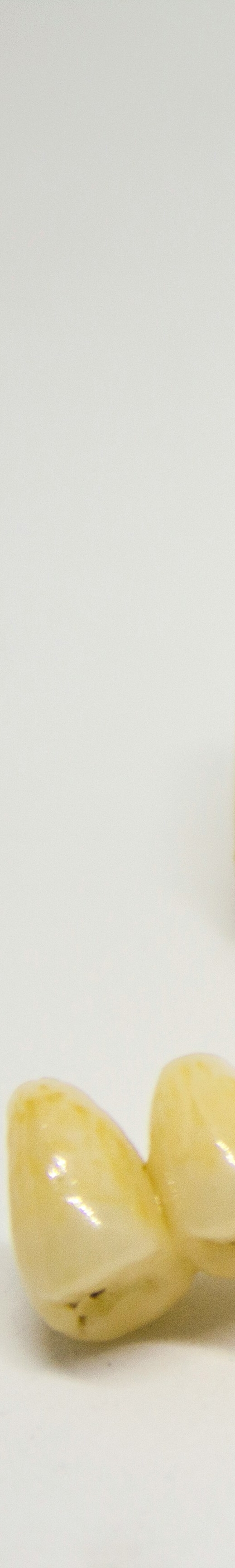 임플란트 후 관리의 중요성 관련 이미지 19