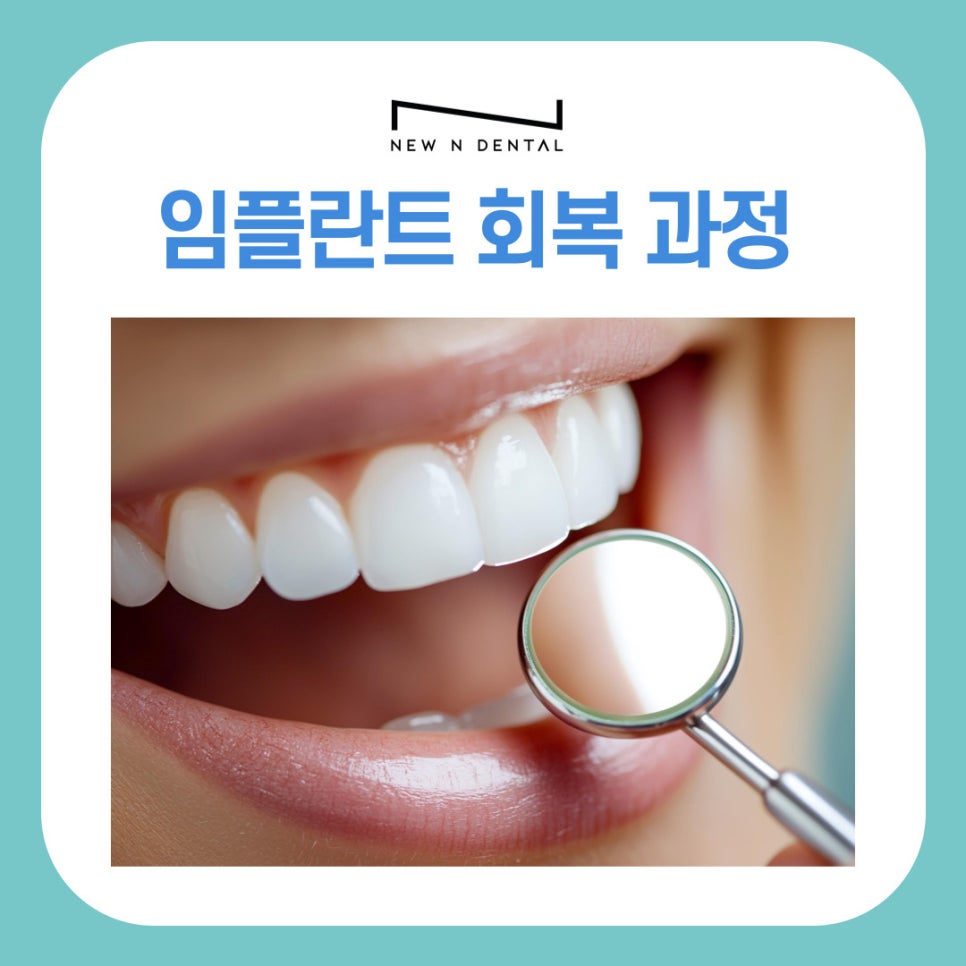 강남역치과 임플란트 식립 후 식사, 회복 과정 따라 달라지는 식단 팁 관련 이미지 5