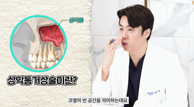 상악동거상술 임플란트 성공률 높이기 관련 이미지 2