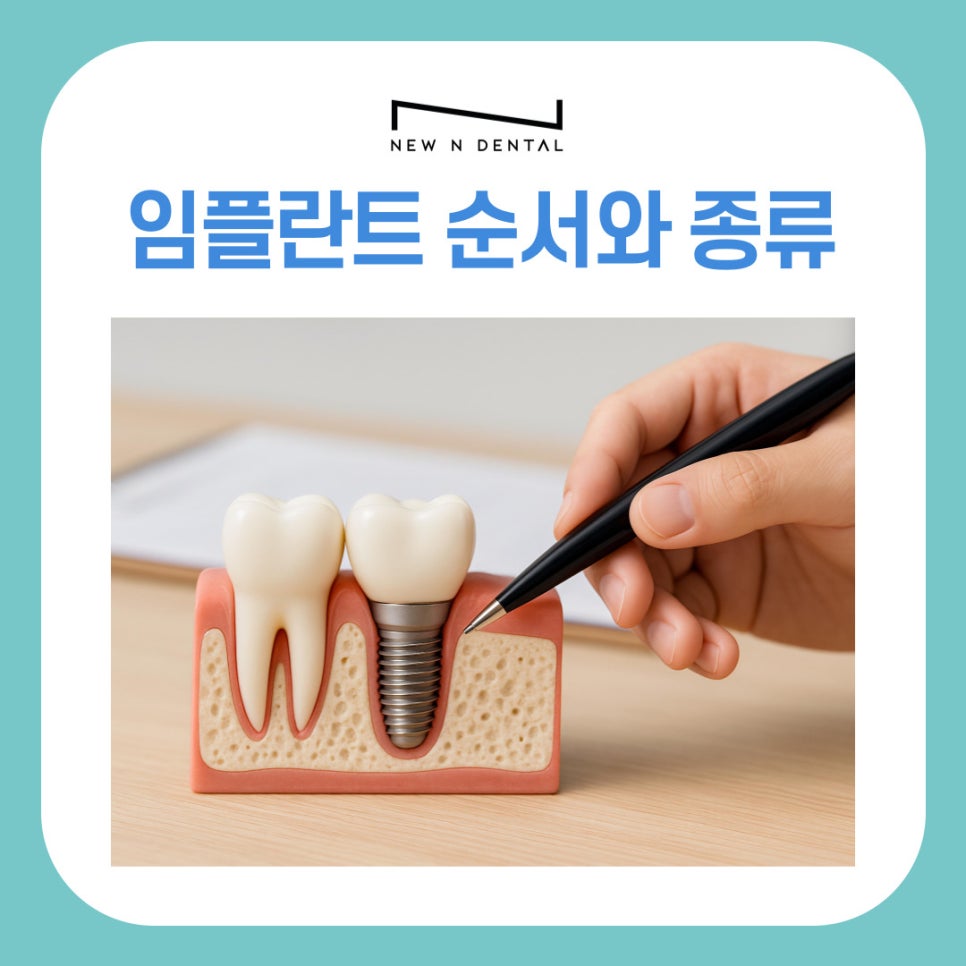 A Complete Guide to Implant Steps and Differences by Type at a Gangnam Station Dental Clinic image 2