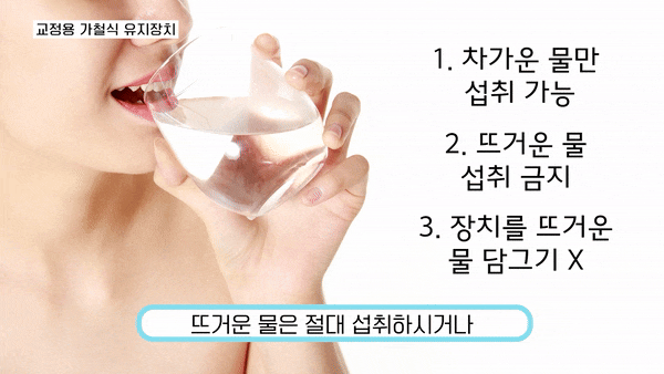 앞니벌어짐교정 나에게 맞는 방법 선택 관련 이미지 7