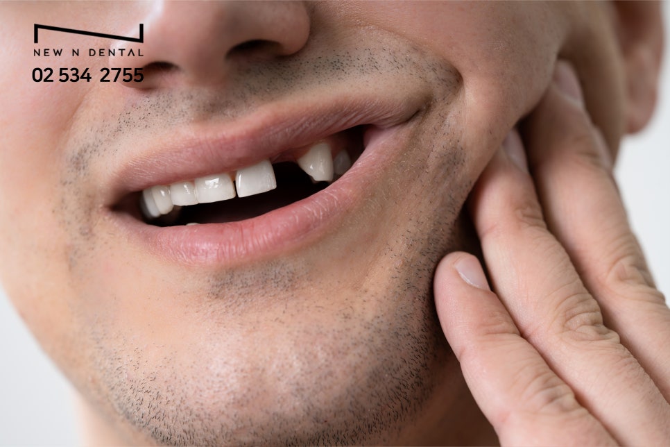 강남역임플란트 치아교정과 함께 치료 관련 이미지 4