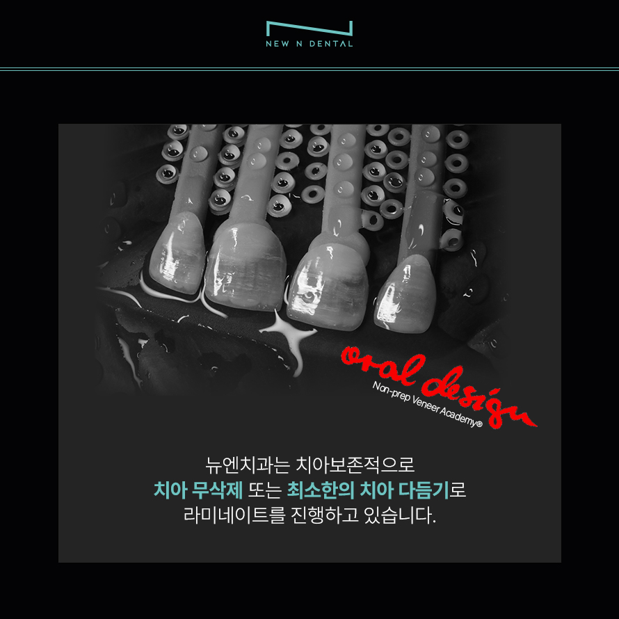 강남 무삭제 라미네이트 뉴엔치과에서 완성하는 아름다운 미소 관련 이미지 2