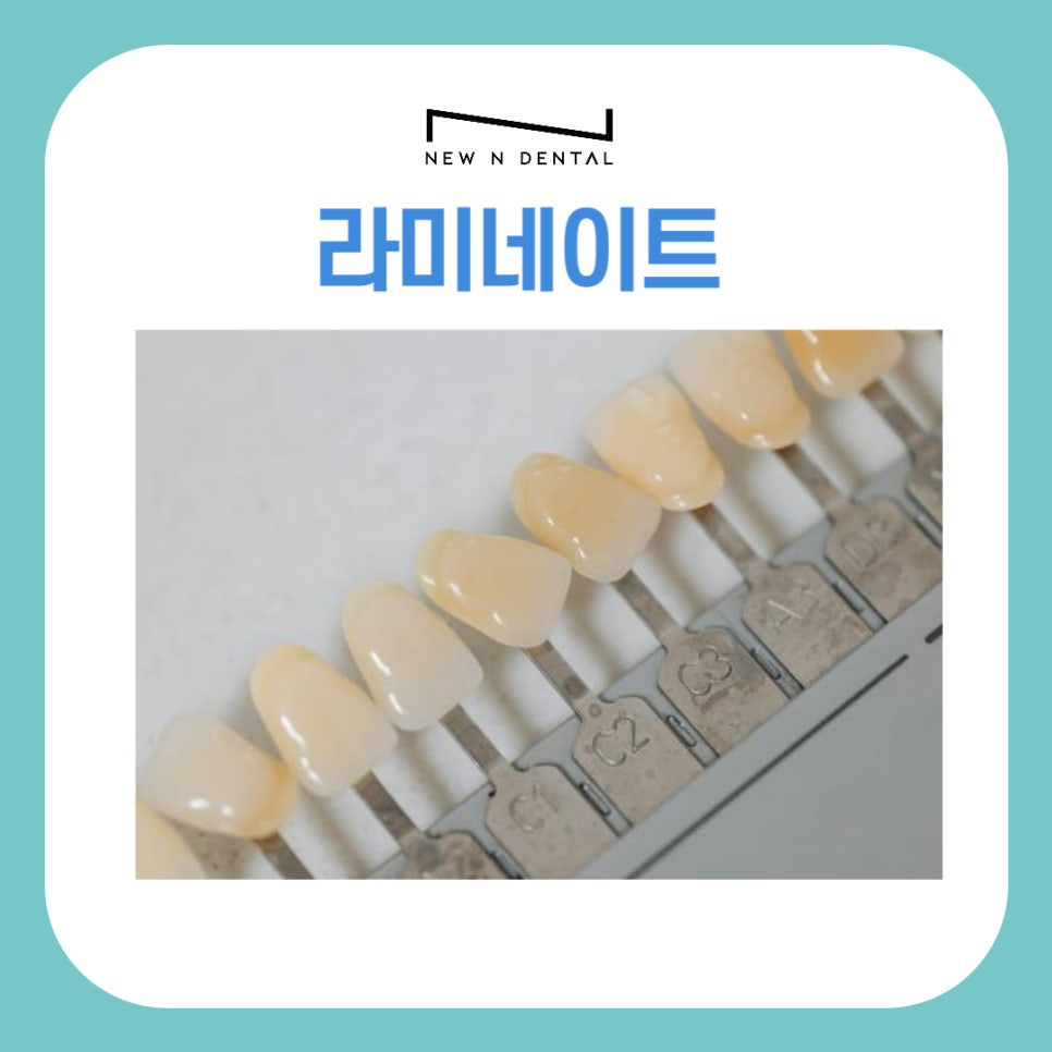 라미네이트 고민한다면 올바른 정보확인하기 관련 이미지 1