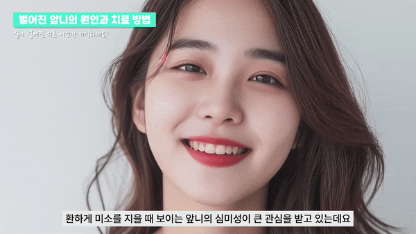 무삭제라미네이트가격 첫인상 가성비 좋은방법 관련 이미지 3