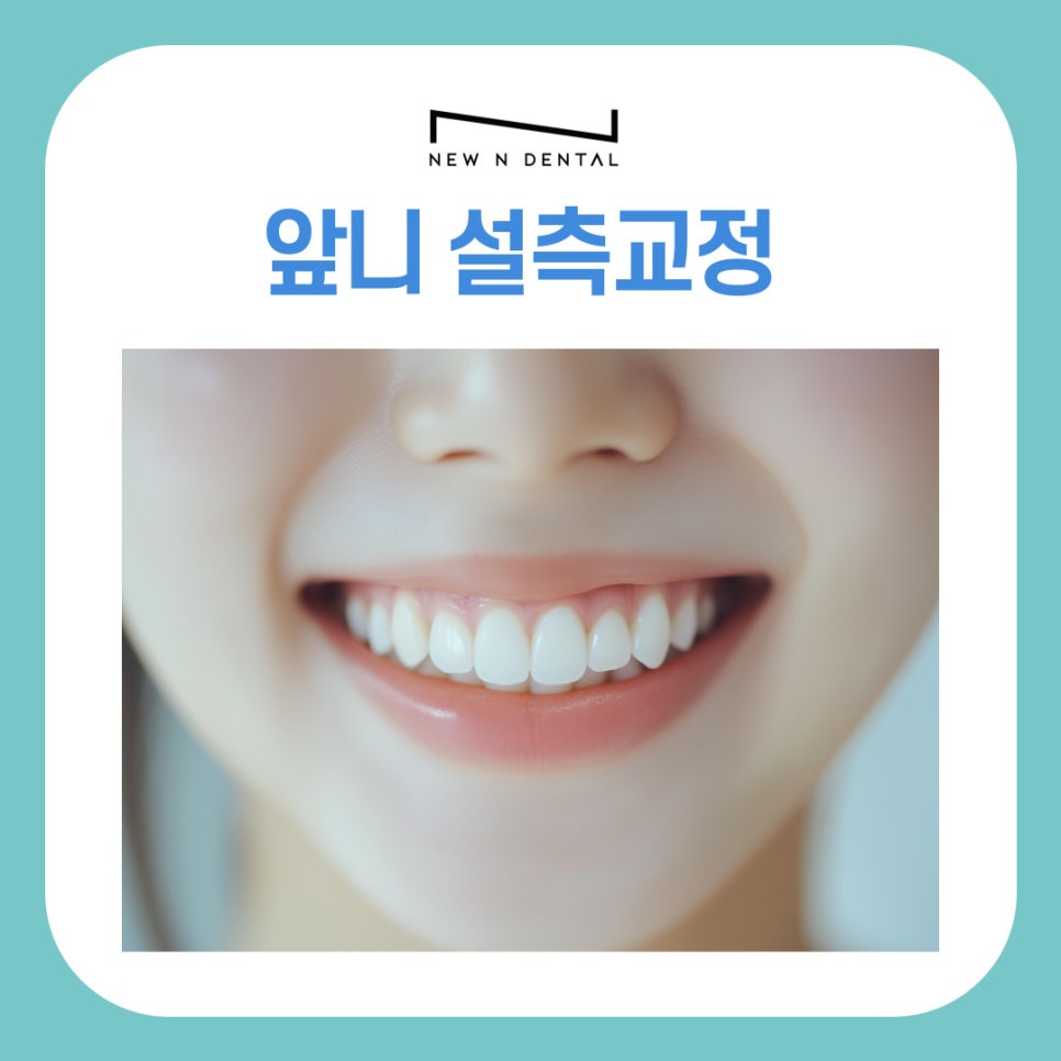 Orthodontics Near Gangnam Station: Differences Between Anterior Lingual Braces and Clear Aligners by Type image 2