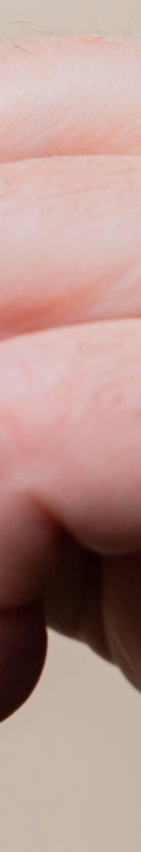 임플란트와 틀니 차이점, 나에게 맞는 선택은? 관련 이미지 32