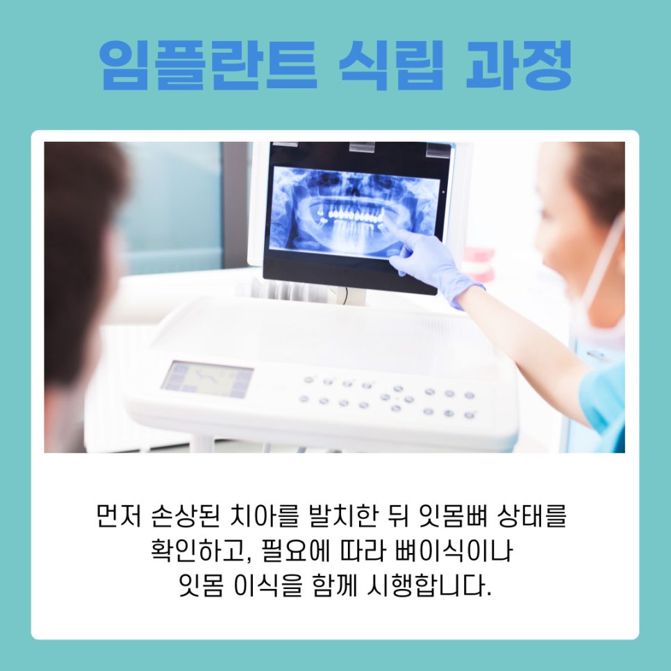 강남역치과 임플란트 식립 후 식사, 회복 과정 따라 달라지는 식단 팁 관련 이미지 4