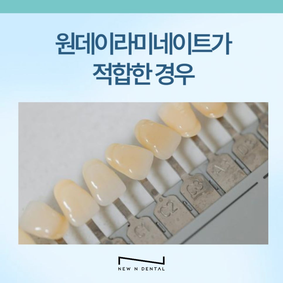 원데이 라미네이트 이런 분들께 추천드립니다 관련 이미지 7