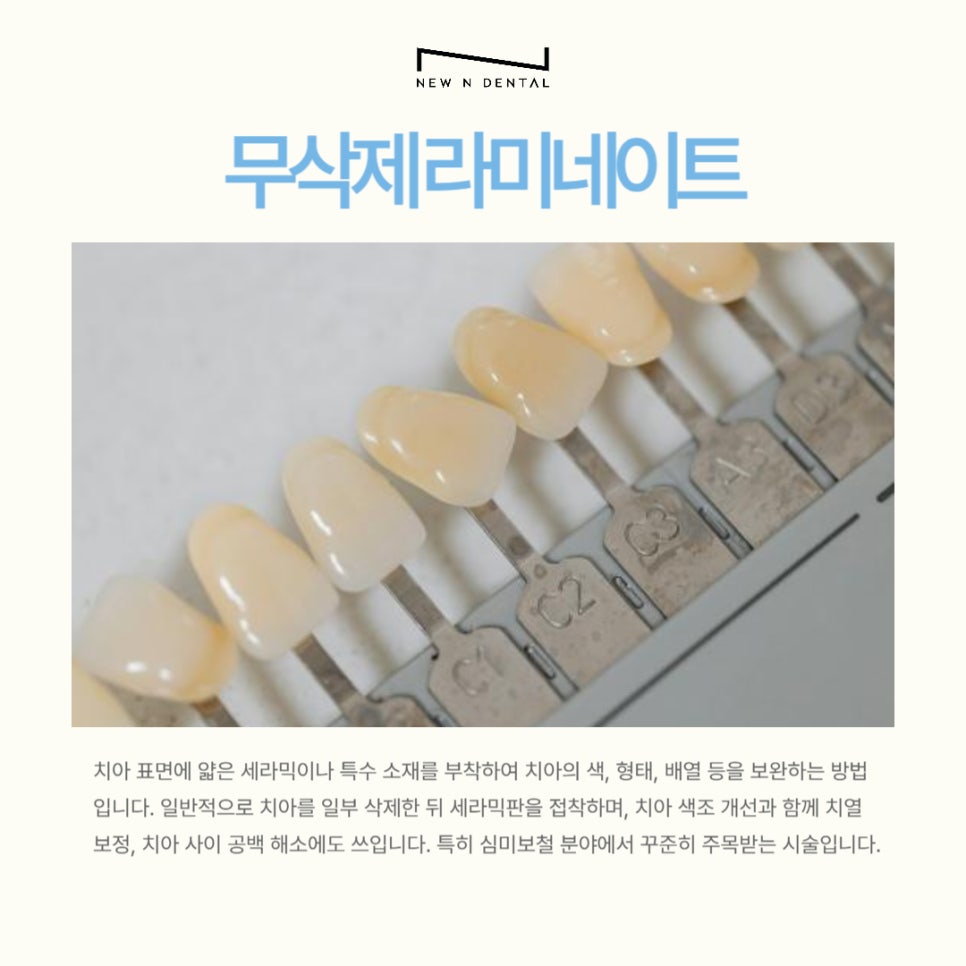 강남 무삭제라미네이트 잘하는 뉴엔치과 자연스러운 미소 관련 이미지 2