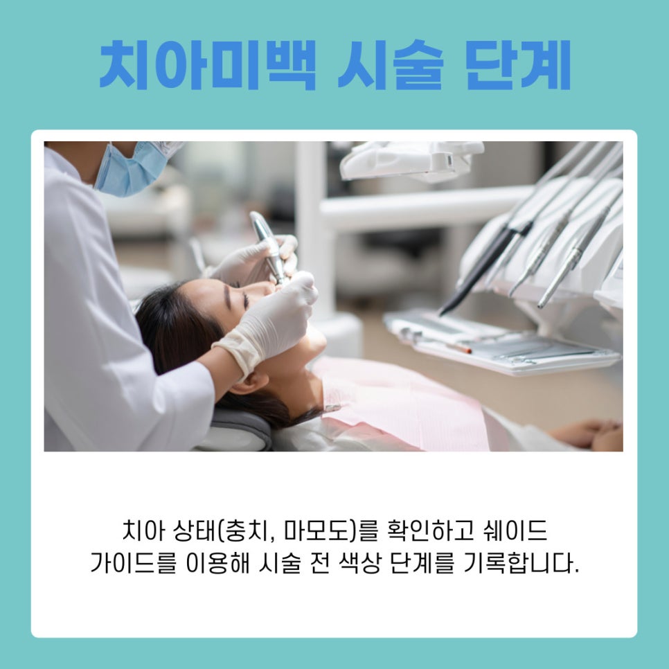 One-Day Teeth Whitening Procedure: A Bright Smile Completed in Just One Day image 8
