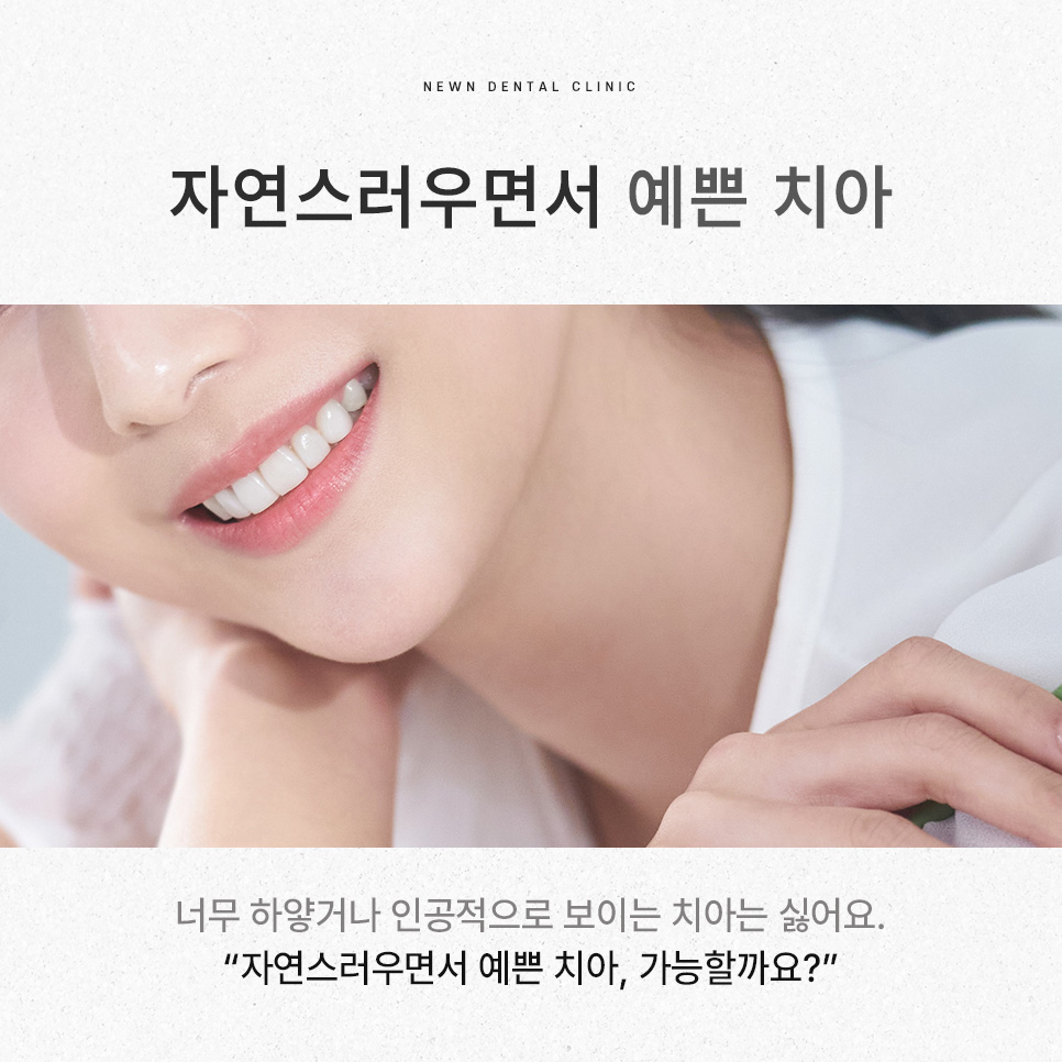 퍼스널라미 네츄럴ㅣ자연스러운 미소를 찾아주는 앞니성형, 무삭제 라미네이트 관련 이미지 2