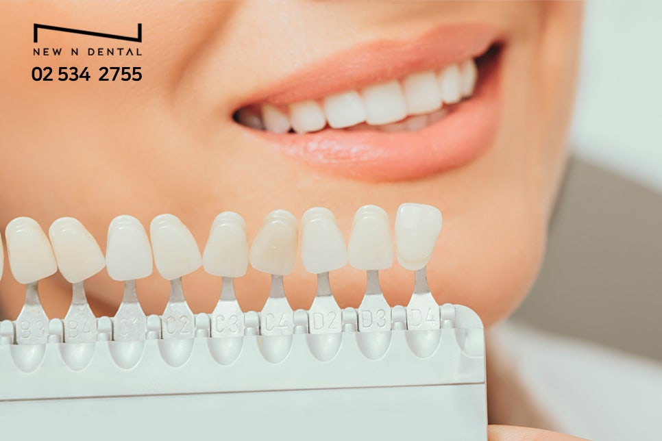 무삭제라미네이트가격 첫인상 가성비 좋은방법 관련 이미지 4