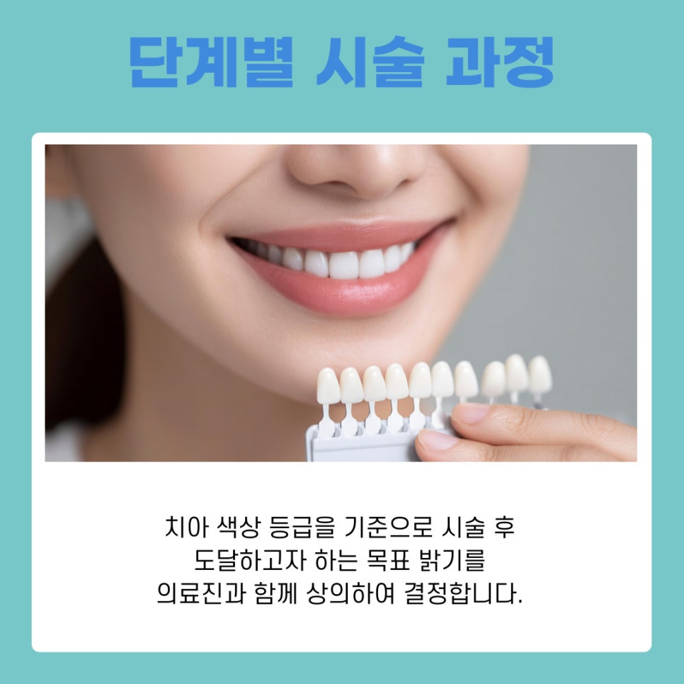 서초동 치아미백 원리와 시술 과정 정리 관련 이미지 7