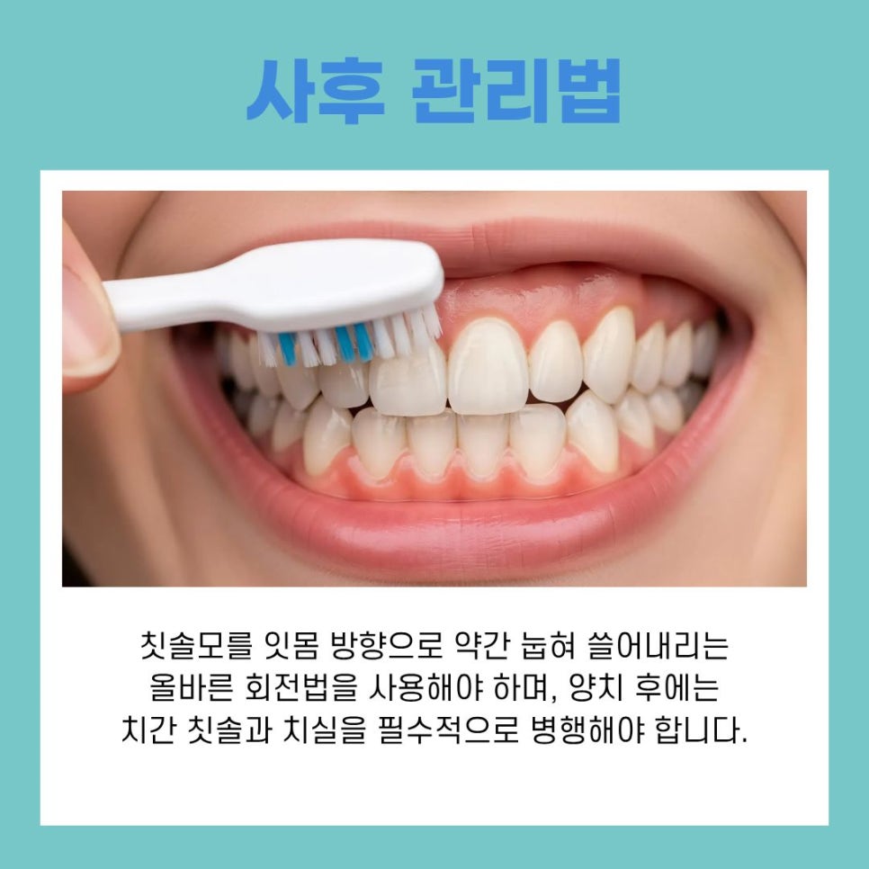 Proper Aftercare and Regular Checkups to Extend the Lifespan of Implants in Gangnam-gu image 8