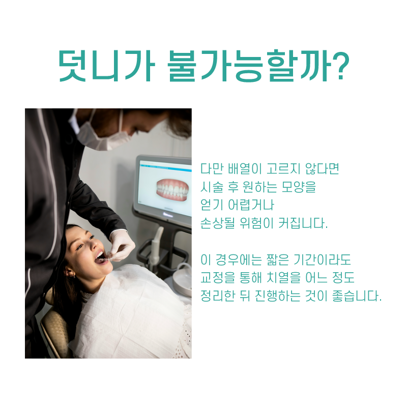 무삭제 라미네이트 저도 받을 수 있을까요? 관련 이미지 7