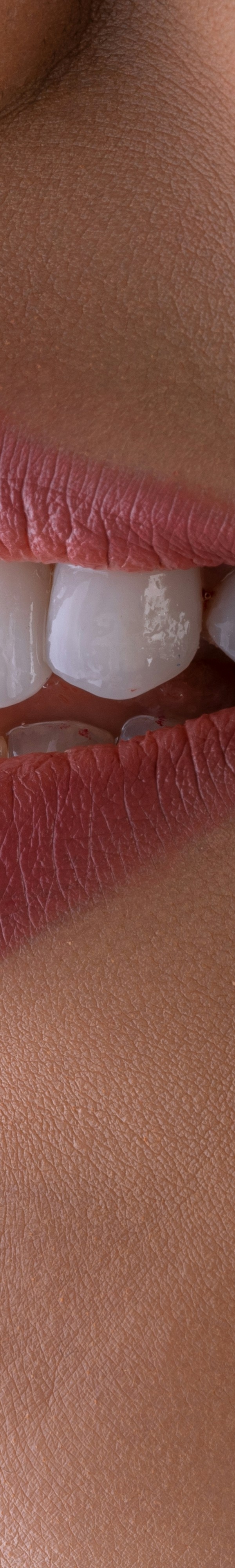 치아교정 후 유지 장치의 필요성 관련 이미지 24