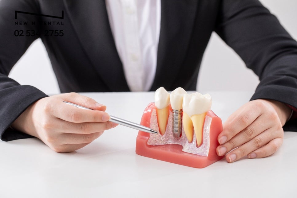 강남임플란트수술 웃음이 아름다워지는 마법 관련 이미지 4