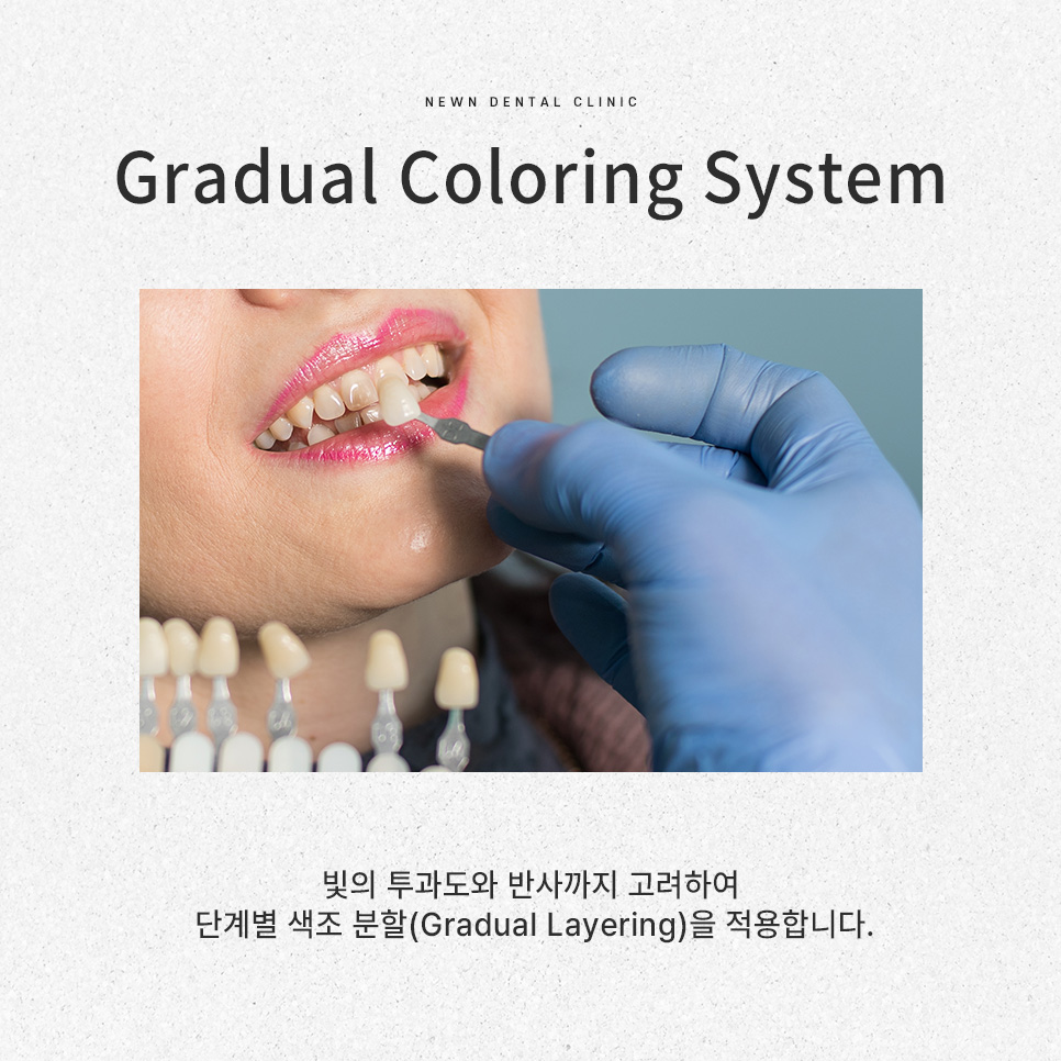 퍼스널라미 네츄럴ㅣ자연스러운 미소를 찾아주는 앞니성형, 무삭제 라미네이트 관련 이미지 7