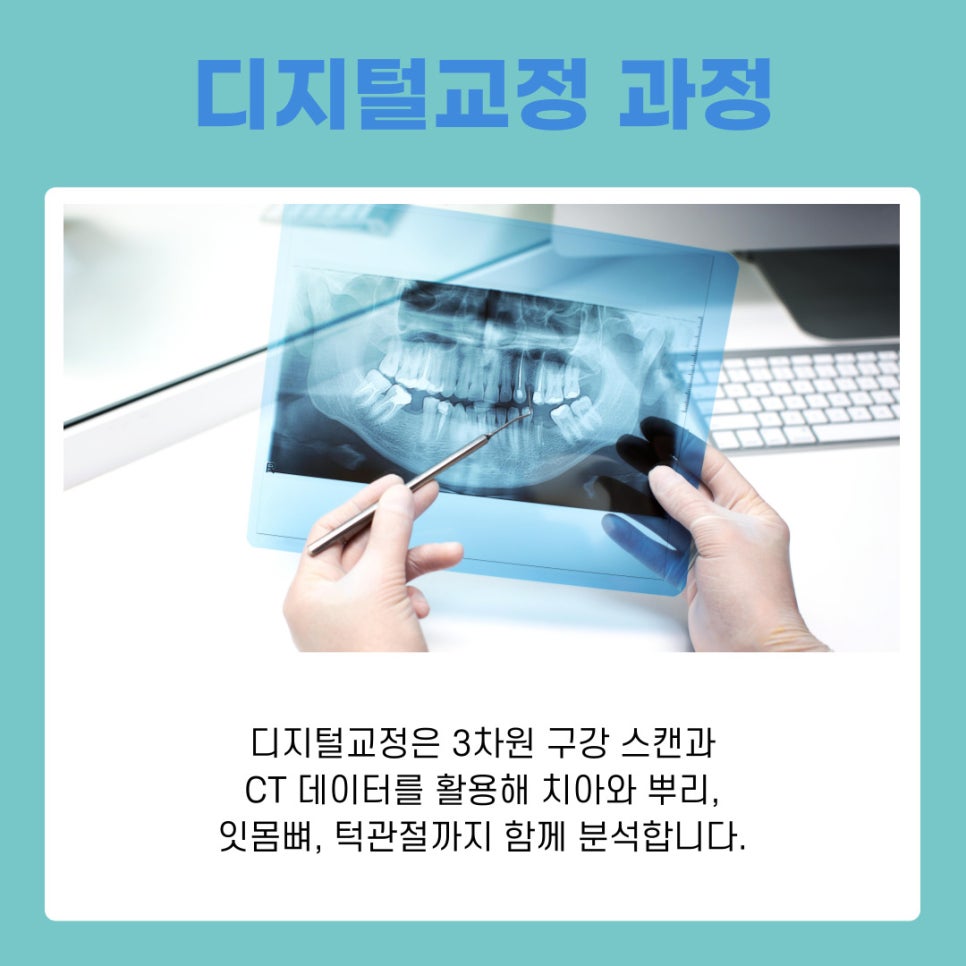 디지털교정 기존 치료와 무엇이 다를까 관련 이미지 4