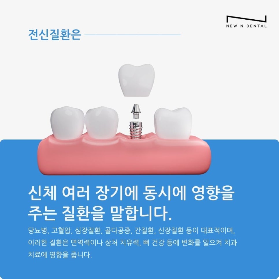 전신질환 환자도 임플란트 할 수 있을까? 안전한 치료방법 관련 이미지 2