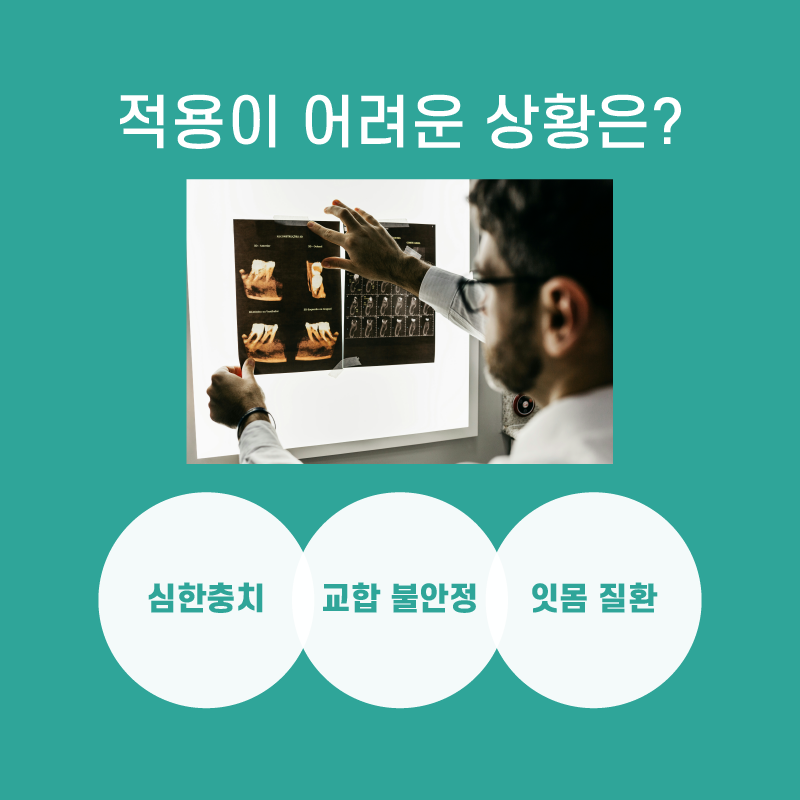 무삭제 라미네이트 저도 받을 수 있을까요? 관련 이미지 6