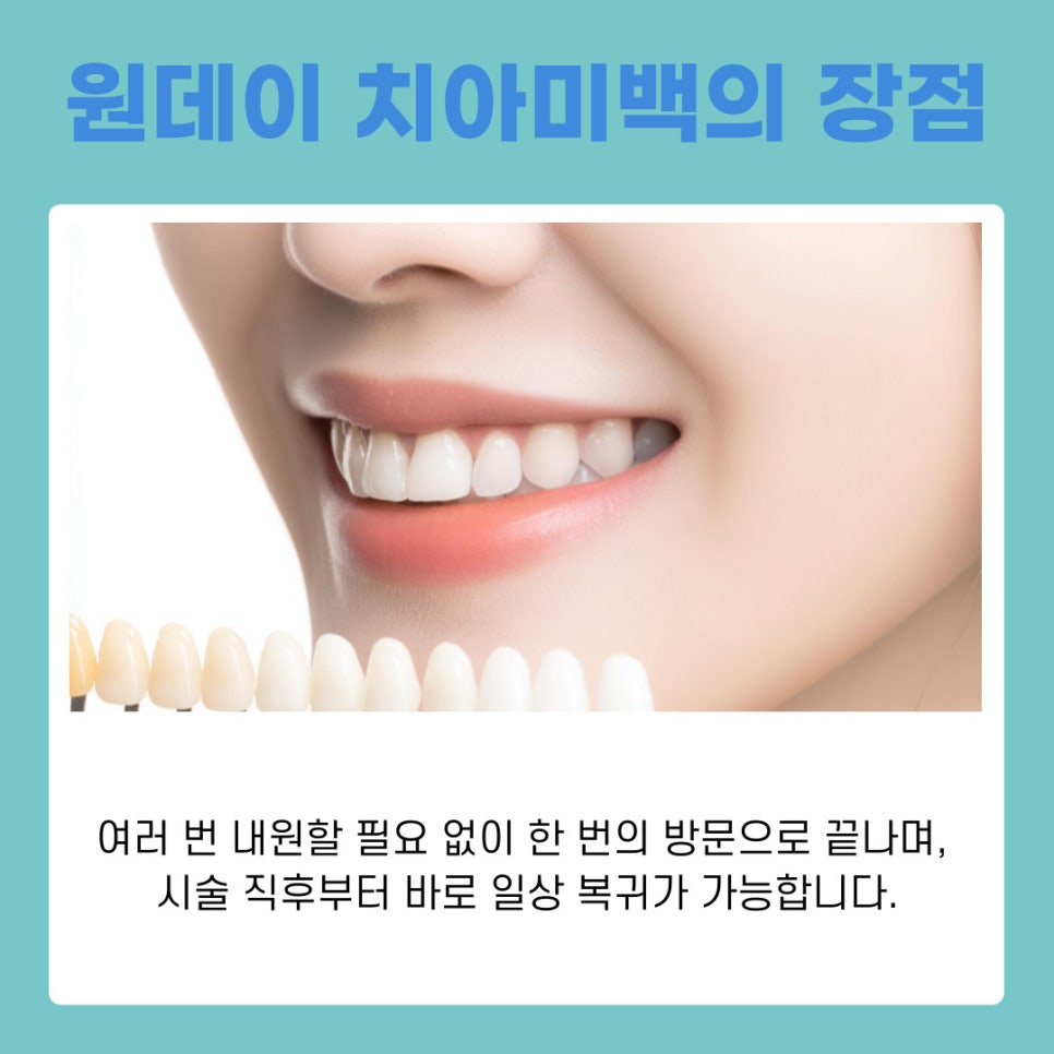 강남역치과추천 시간 없는 직장인도 가능한 원데이치아미백 관련 이미지 8