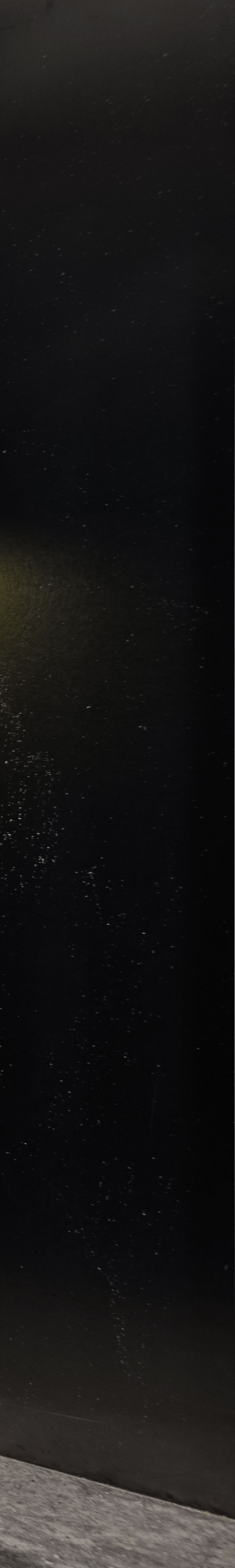 강남 무삭제라미네이트 잘하는 뉴엔치과 자연스러운 미소 관련 이미지 28