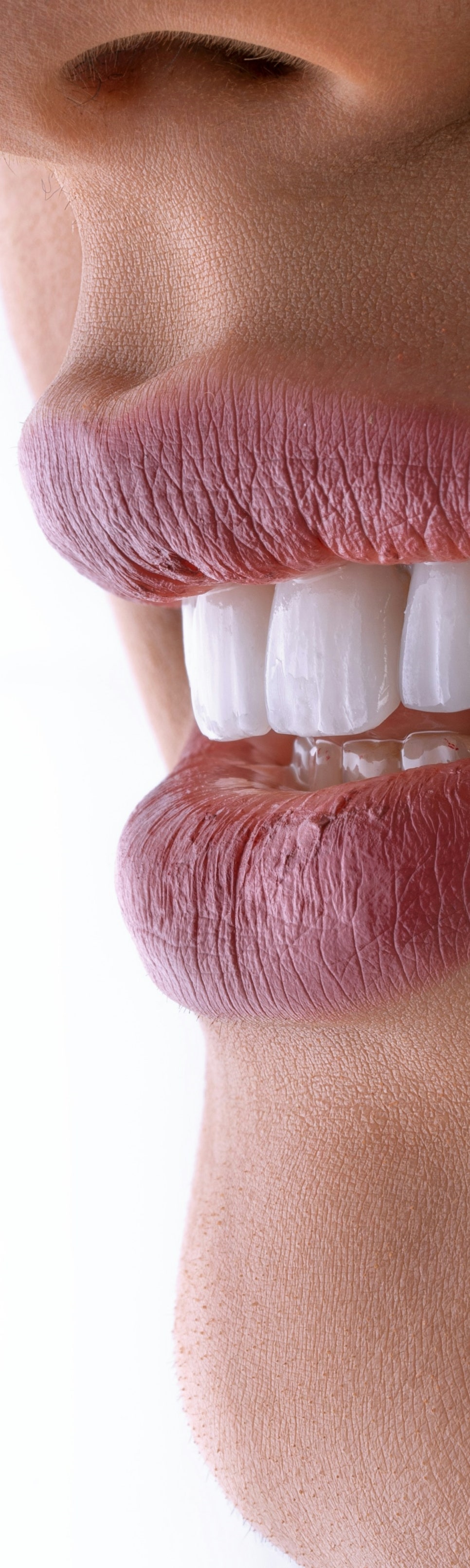 투명교정으로 치아 변화를 위해 관련 이미지 10