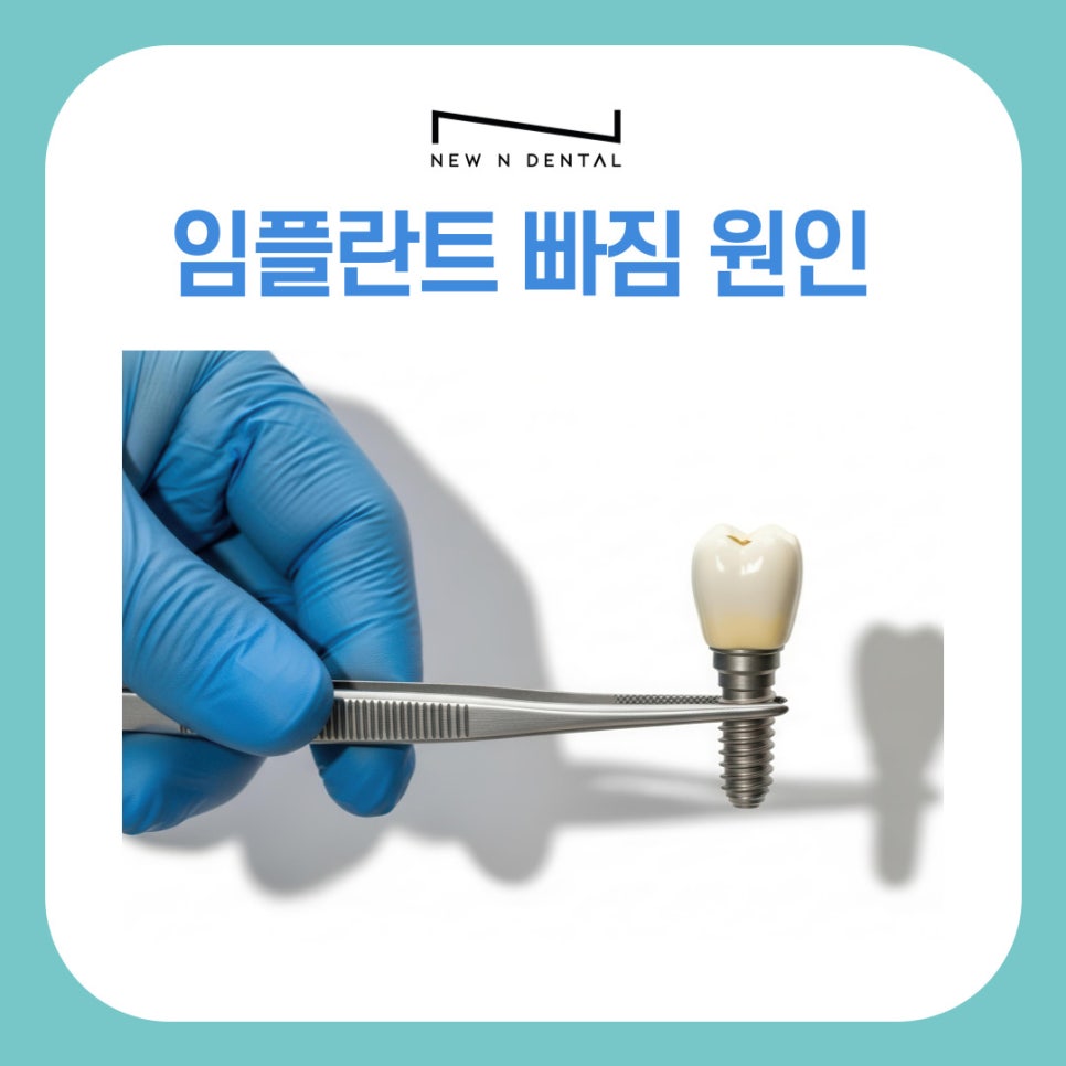 강남논현동치과 임플란트 빠짐 원인과 재치료 가능성 정리 관련 이미지 2