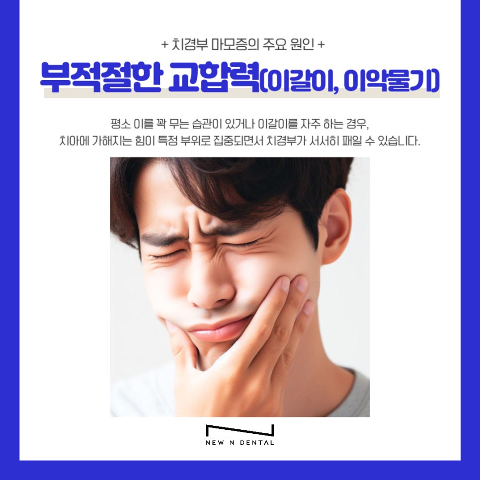 신논현치과 치경부마모증 원인과 치료 관련 이미지 6