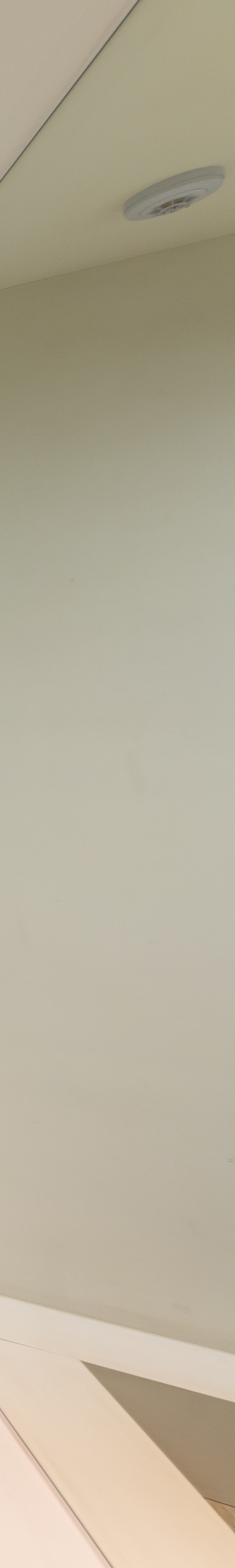 임플란트부분틀니 장단점과 치료방법은 관련 이미지 34