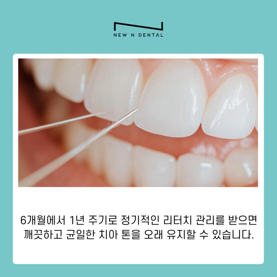 강남역치과추천 퍼스널라미 시술후 관리 가이드 관련 이미지 7