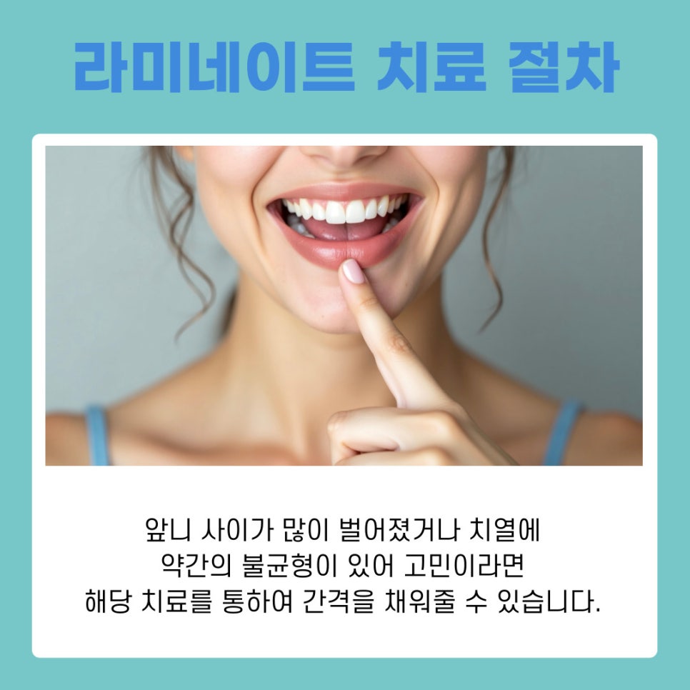 역삼동치과 라미네이트 하고 싶다면 어떤 점을 고려할까 관련 이미지 8