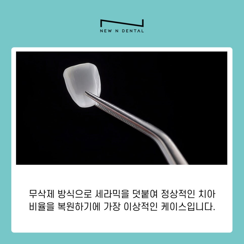 무삭제 라미네이트 특징 및 관리법 관련 이미지 8