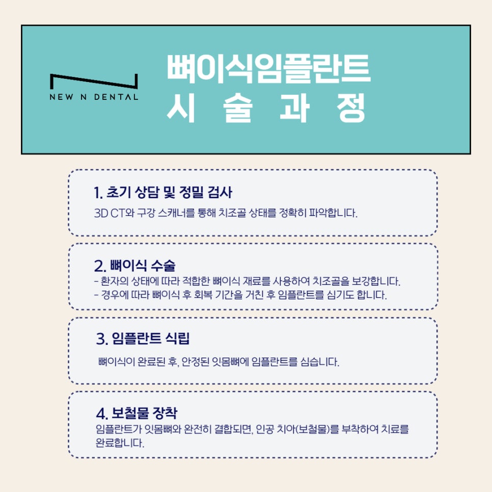 강남역 임플란트 뼈이식 잘하는 곳 뉴엔치과 관련 이미지 9