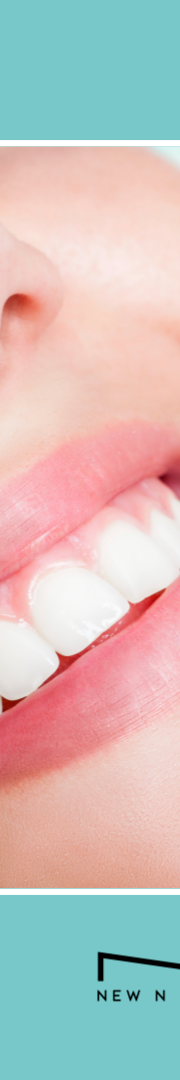 치아변색원인과 스케일링치료로 개선하는 방법 관련 이미지 12