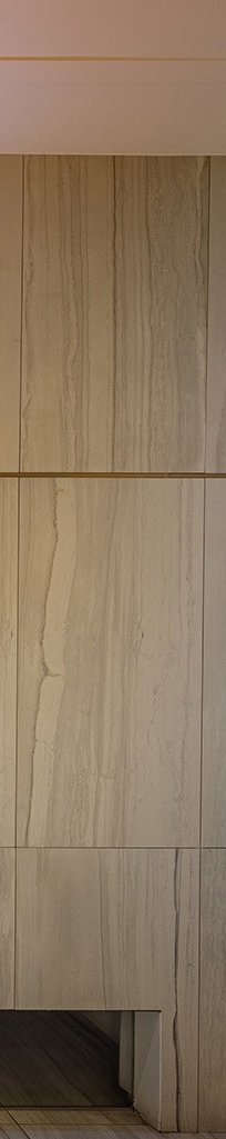 앞니심미치료로 되찾는 자연스러운 스마일 라인 관련 이미지 22