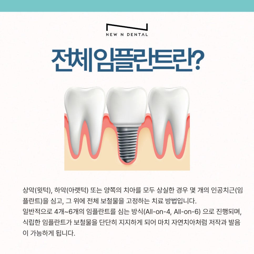 강남 전체임플란트 틀니 생각하고 있다면 관련 이미지 3