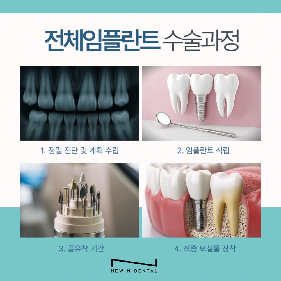강남 전체임플란트 틀니 생각하고 있다면 관련 이미지 8