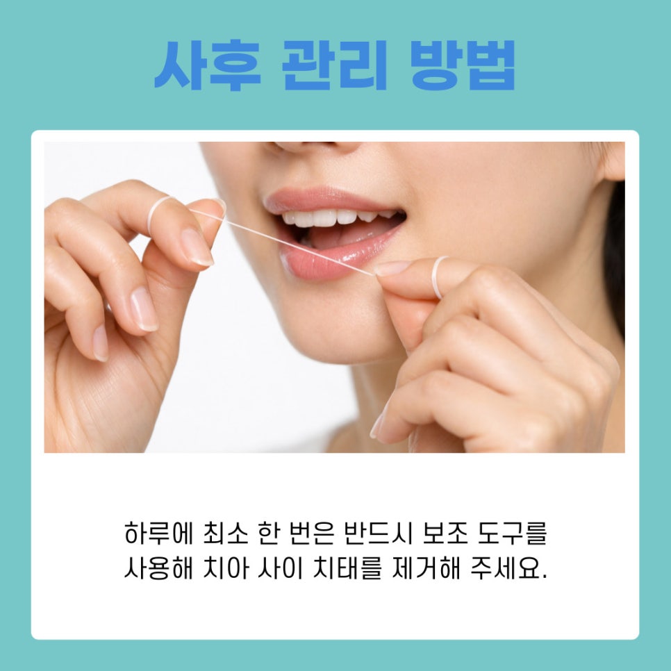 Gingivitis Treatment and Management: A Guide to Healthy Gums image 9