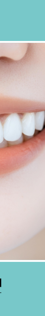 강남 무삭제 라미네이트 치아 손상 없이 예뻐지는 방법 관련 이미지 14