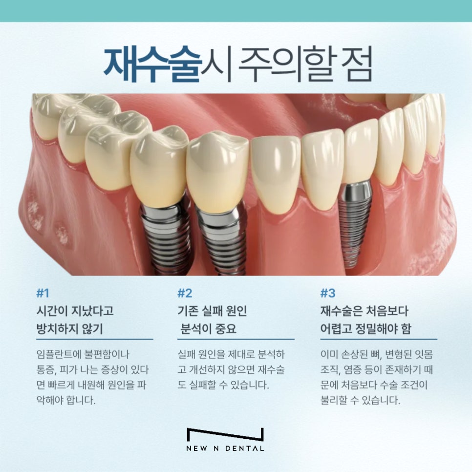 임플란트 재수술, 꼭 필요한 경우만 진행해야 합니다 관련 이미지 6