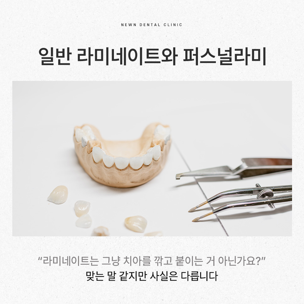 강남역 뉴엔치과 일반 라미네이트와 퍼스널라미의 차이점 관련 이미지 3